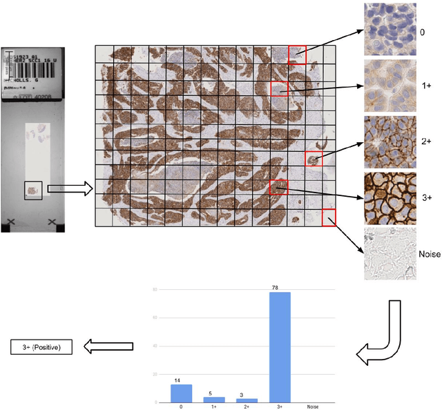 Figure 3 for An Automatic Patch-based Approach for HER-2 Scoring in Immunohistochemical Breast Cancer Images Using Color Features