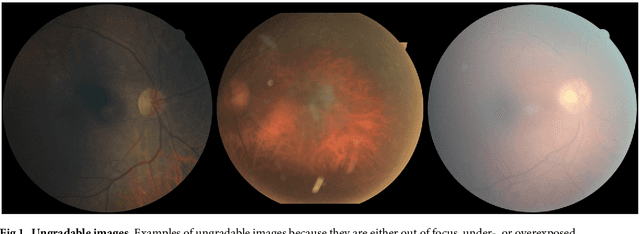 Figure 1 for Replication study: Development and validation of deep learning algorithm for detection of diabetic retinopathy in retinal fundus photographs