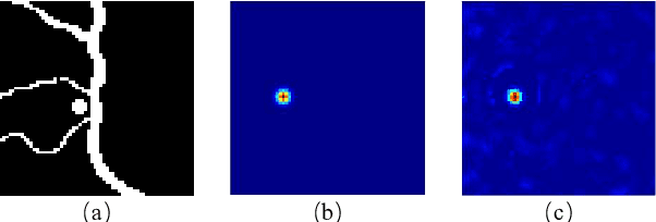 Figure 1 for Deep Learning Enables Robust and Precise Light Focusing on Treatment Needs