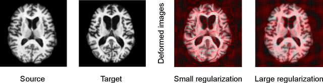 Figure 1 for Deep Learning for Regularization Prediction in Diffeomorphic Image Registration