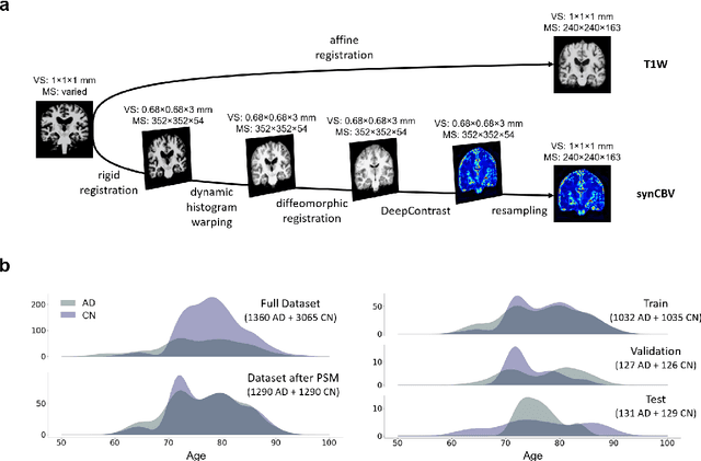 Figure 1 for Deep Learning Identifies Neuroimaging Signatures of Alzheimer's Disease Using Structural and Synthesized Functional MRI Data