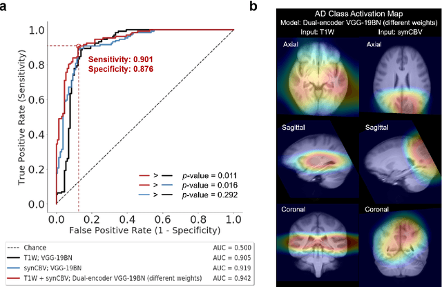 Figure 4 for Deep Learning Identifies Neuroimaging Signatures of Alzheimer's Disease Using Structural and Synthesized Functional MRI Data