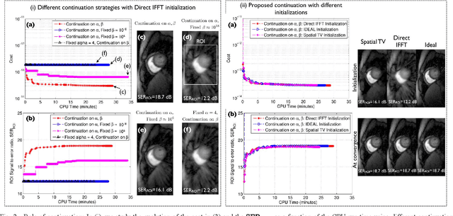 Figure 2 for Deformation corrected compressed sensing (DC-CS): a novel framework for accelerated dynamic MRI