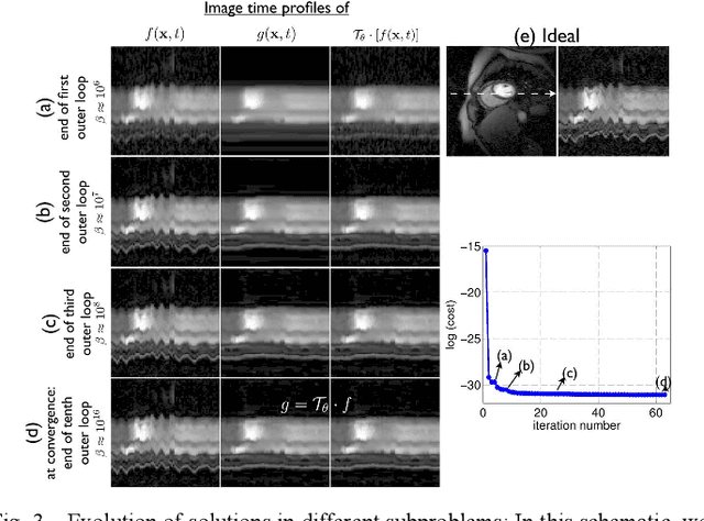 Figure 3 for Deformation corrected compressed sensing (DC-CS): a novel framework for accelerated dynamic MRI