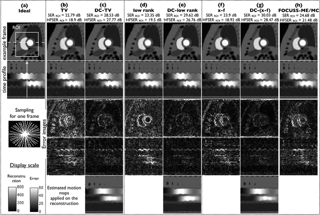 Figure 4 for Deformation corrected compressed sensing (DC-CS): a novel framework for accelerated dynamic MRI