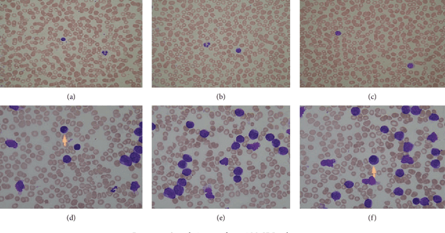 Figure 1 for Robust Method for Semantic Segmentation of Whole-Slide Blood Cell Microscopic Image