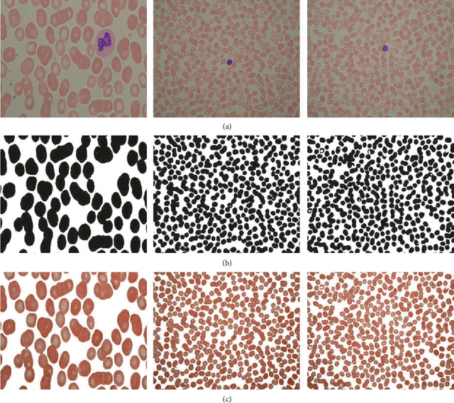 Figure 3 for Robust Method for Semantic Segmentation of Whole-Slide Blood Cell Microscopic Image