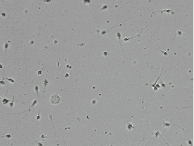 Figure 3 for Foldover Features for Dynamic Object Behavior Description in Microscopic Videos