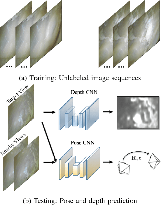 Figure 1 for Unsupervised Odometry and Depth Learning for Endoscopic Capsule Robots