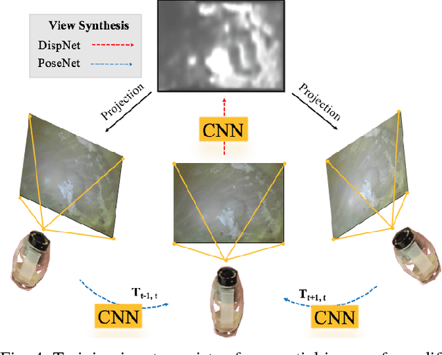 Figure 4 for Unsupervised Odometry and Depth Learning for Endoscopic Capsule Robots