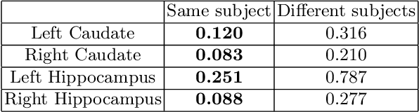 Figure 2 for 3D Deep Affine-Invariant Shape Learning for Brain MR Image Segmentation