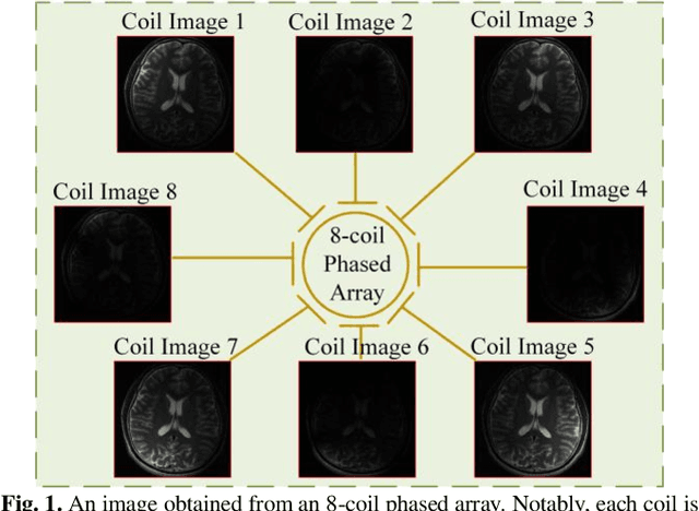 Figure 1 for Virtual Coil Augmentation Technology for MRI via Deep Learning