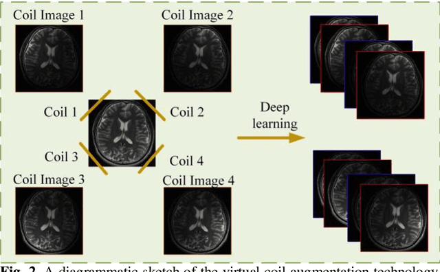 Figure 3 for Virtual Coil Augmentation Technology for MRI via Deep Learning