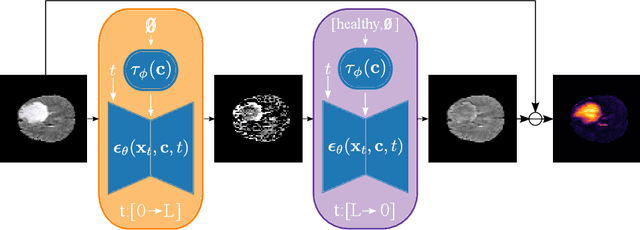 Figure 1 for What is Healthy? Generative Counterfactual Diffusion for Lesion Localization
