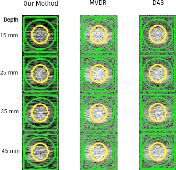 Figure 4 for Patch Based Transformation for Minimum Variance Beamformer Image Approximation Using Delay and Sum Pipeline