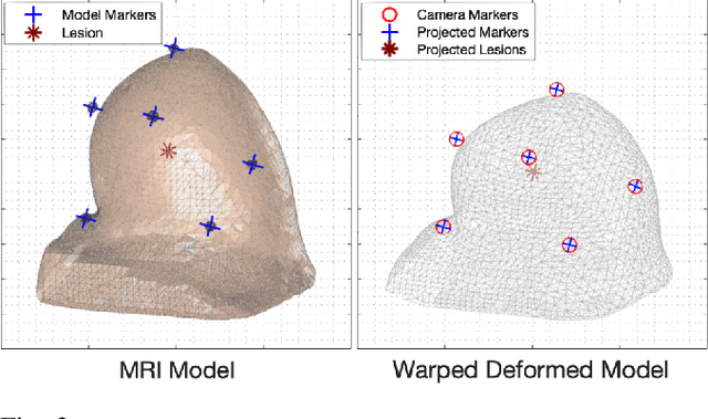 Figure 3 for Image-guided Breast Biopsy of MRI-visible Lesions with a Hand-mounted Motorised Needle Steering Tool