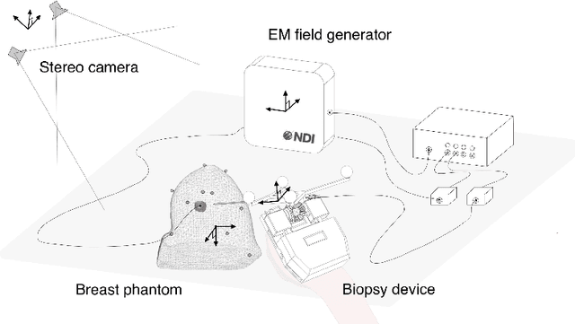 Figure 4 for Image-guided Breast Biopsy of MRI-visible Lesions with a Hand-mounted Motorised Needle Steering Tool