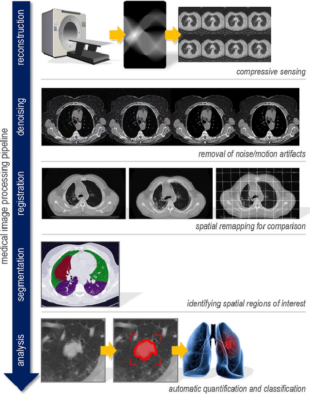 Figure 1 for Synthetic Lung Nodule 3D Image Generation Using Autoencoders