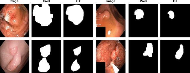 Figure 4 for Multi-centred Strong Augmentation via Contrastive Learning for Unsupervised Lesion Detection and Segmentation