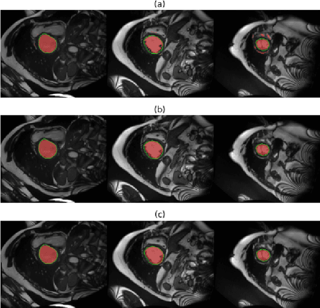 Figure 3 for Hybrid Forests for Left Ventricle Segmentation using only the first slice label