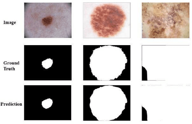 Figure 2 for Dermoscopic Image Analysis for ISIC Challenge 2018