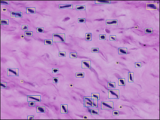 Figure 3 for Towards Deep Cellular Phenotyping in Placental Histology