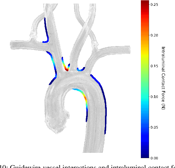 Figure 2 for Image-based Intraluminal Contact Force Monitoring in Robotic Vascular Navigation