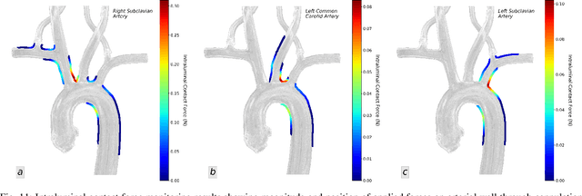 Figure 3 for Image-based Intraluminal Contact Force Monitoring in Robotic Vascular Navigation