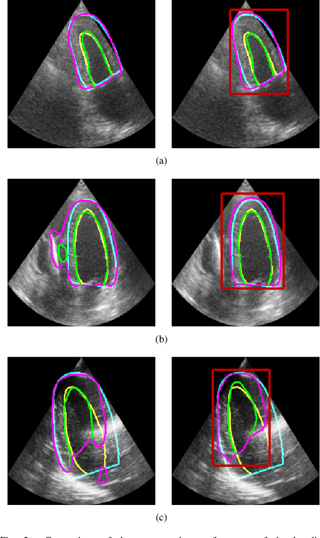 Figure 2 for LU-Net: a multi-task network to improve the robustness of segmentation of left ventriclular structures by deep learning in 2D echocardiography