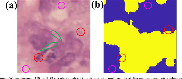 Figure 3 for Clustering and classification of low-dimensional data in explicit feature map domain: intraoperative pixel-wise diagnosis of adenocarcinoma of a colon in a liver