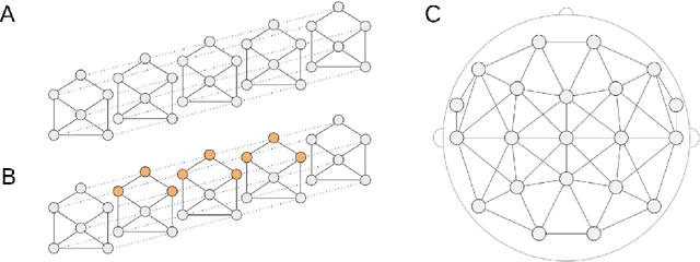 Figure 1 for Temporal Graph Convolutional Networks for Automatic Seizure Detection