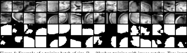 Figure 4 for TorchIO: a Python library for efficient loading, preprocessing, augmentation and patch-based sampling of medical images in deep learning