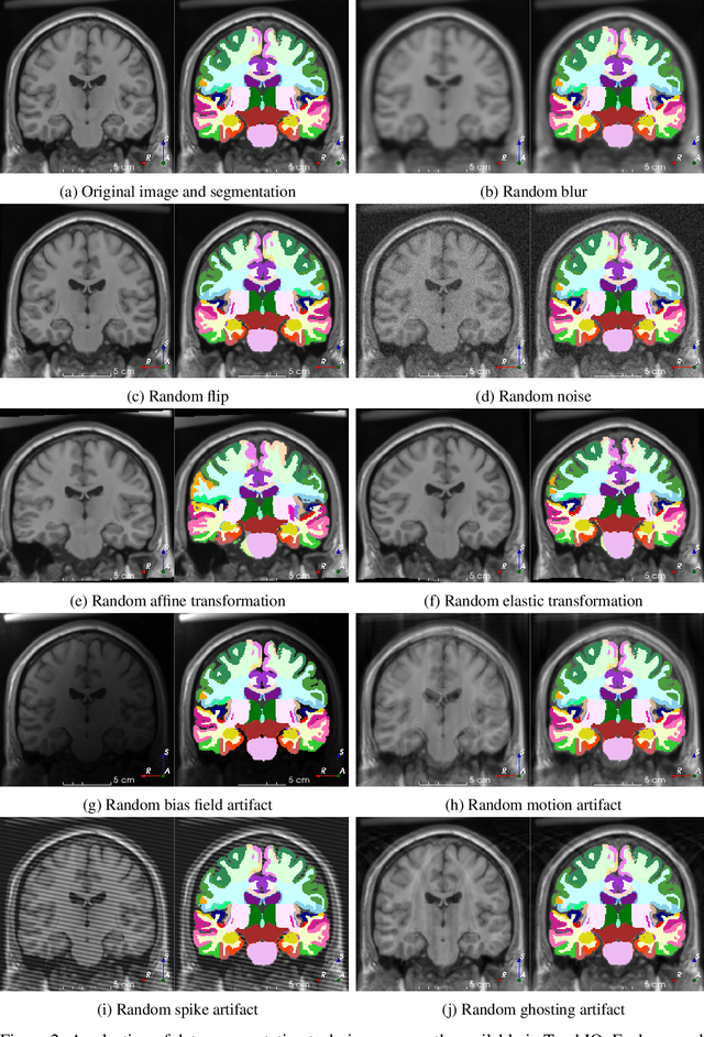 Figure 2 for TorchIO: a Python library for efficient loading, preprocessing, augmentation and patch-based sampling of medical images in deep learning