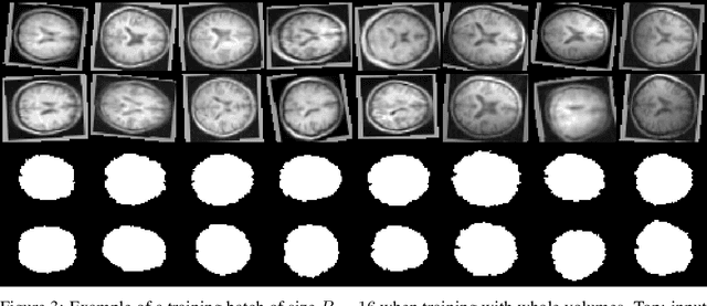 Figure 3 for TorchIO: a Python library for efficient loading, preprocessing, augmentation and patch-based sampling of medical images in deep learning