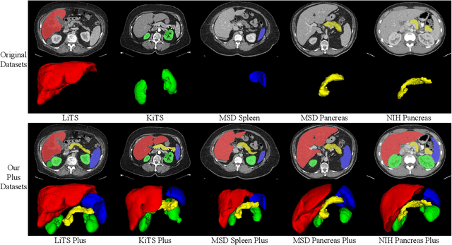 Figure 3 for AbdomenCT-1K: Is Abdominal Organ Segmentation A Solved Problem?