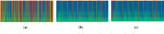 Figure 3 for Convolutional neural network for breathing phase detection in lung sounds