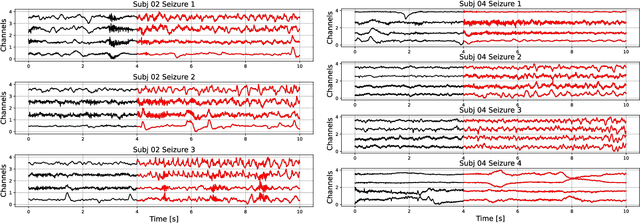 Figure 1 for Multi-Centroid Hyperdimensional Computing Approach for Epileptic Seizure Detection