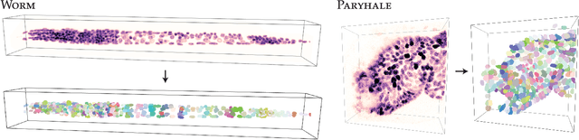 Figure 4 for Star-convex Polyhedra for 3D Object Detection and Segmentation in Microscopy