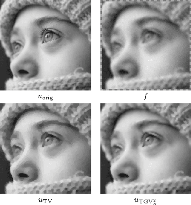Figure 2 for Inverse problems with second-order Total Generalized Variation constraints
