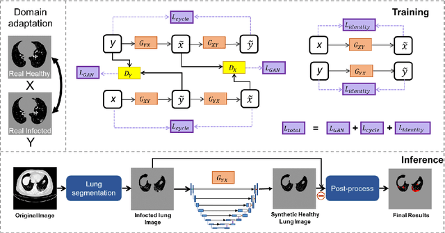Figure 2 for Unsupervised COVID-19 Lesion Segmentation in CT Using Cycle Consistent Generative Adversarial Network