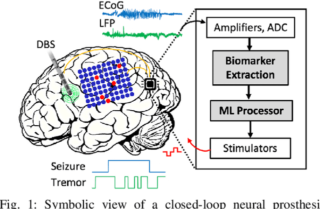 Figure 1 for Closed-Loop Neural Prostheses with On-Chip Intelligence: A Review and A Low-Latency Machine Learning Model for Brain State Detection