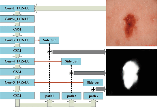 Figure 1 for Deep attention-guided fusion network for lesion segmentation