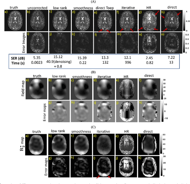 Figure 3 for Calibration-free B0 correction of EPI data using structured low rank matrix recovery