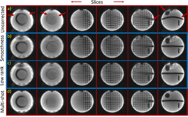 Figure 4 for Calibration-free B0 correction of EPI data using structured low rank matrix recovery