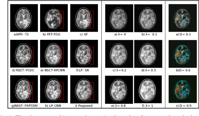 Figure 3 for Structural Similarity based Anatomical and Functional Brain Imaging Fusion