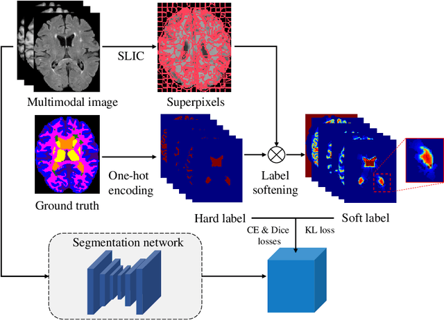 Figure 3 for Superpixel-Guided Label Softening for Medical Image Segmentation