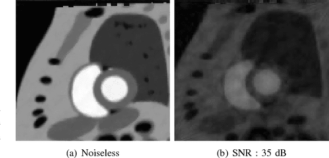 Figure 3 for Subspace based low rank and joint sparse matrix recovery
