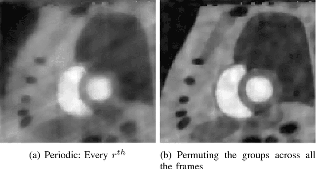 Figure 4 for Subspace based low rank and joint sparse matrix recovery