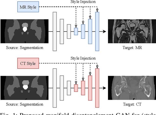 Figure 1 for Manipulating Medical Image Translation with Manifold Disentanglement