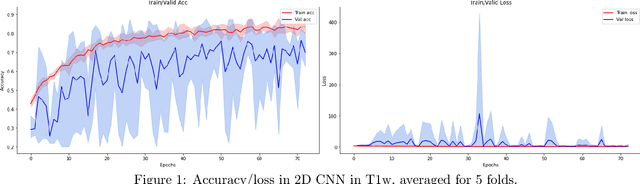 Figure 1 for Infant Brain Age Classification: 2D CNN Outperforms 3D CNN in Small Dataset